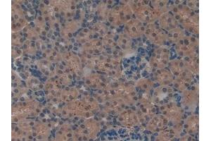 Detection of LIFR in Rat Kidney Tissue using Polyclonal Antibody to Leukemia Inhibitory Factor Receptor (LIFR)