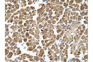 Tropomyosin 2 antibody was used for immunohistochemistry at a concentration of 4-8 ug/ml. (TPM2 anticorps)