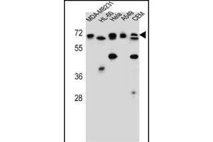 ASMTL Antibody (Center) (ABIN657160 and ABIN2846294) western blot analysis in MDA-M,HL-60,Hela,A549,CEM cell line lysates (35 μg/lane). (ASMTL anticorps  (AA 231-259))