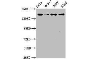 Western Blot Positive WB detected in: Hela whole cell lysate, MCF-7 whole cell lysate, 293T whole cell lysate, K562 whole cell lysate All lanes: HDAC9 antibody at 1. (Recombinant HDAC9 anticorps)