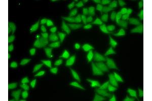 Immunofluorescence analysis of MCF-7 cells using R antibody (ABIN6131708, ABIN6141226, ABIN6141228 and ABIN6217372). (GNB2L1 anticorps  (AA 30-290))