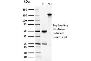 SDS-PAGE Analysis Purified CA8 Mouse Monoclonal Antibody (CPTC-CA8-2). (CA8 anticorps)