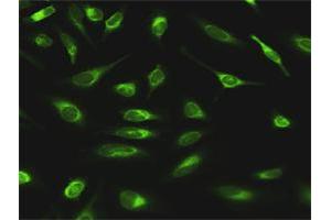 Immunofluorescence of purified MaxPab antibody to GANAB on HeLa cell.