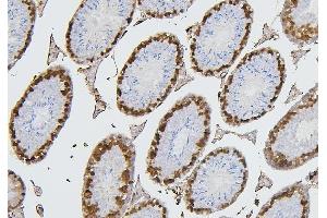 IHC analysis of CDK1 using anti-CDK1 antibody (ABIN7602240). (CDK1 anticorps  (AA 66-297))