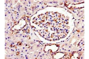 Immunohistochemistry of paraffin-embedded human kidney tissue using ABIN7150297 at dilution of 1:100 (SWI5 anticorps  (AA 54-112))