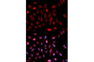 Immunofluorescence analysis of U2OS cells using ASH2L antibody (ABIN5973125). (ASH2L anticorps)