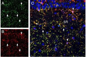 Multiplex staining of CX3CR1 and CD11b in rat hippocampus. (Chemokine (C-X3-C Motif) Receptor 1 (CX3CR1) Peptide)