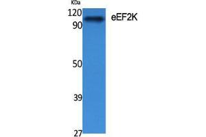 Western Blot (WB) analysis of specific cells using eEF2K Polyclonal Antibody.