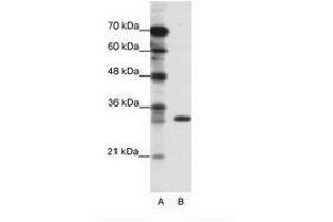 Image no. 1 for anti-Ts Translation Elongation Factor, Mitochondrial (TSFM) (C-Term) antibody (ABIN202296) (TSFM anticorps  (C-Term))