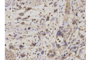 Immunohistochemistry (IHC) image for anti-GDP Dissociation Inhibitor 1 (GDI1) antibody (ABIN1876650) (GDI1 anticorps)