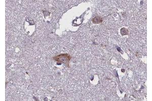 ABIN6267670 at 1/100 staining human brain tissue sections by IHC-P. (TRKB anticorps  (pTyr706))