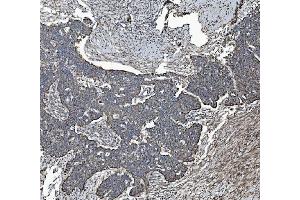 IHC analysis of REA/PHB2 using anti-REA/PHB2 antibody (ABIN7599239). (Prohibitin 2 anticorps  (AA 1-299))