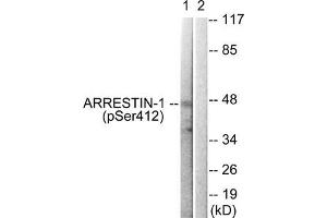 Western blot analysis of extracts from COS7 cells treated with Etoposide using Arrestin 1 (Phospho-Ser412) Antibody. (beta Arrestin 1 anticorps  (pSer412))