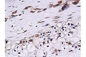 Formalin-fixed and paraffin embedded human placenta labeled with Anti-Cystatin B Polyclonal Antibody, Unconjugated (ABIN755692) at 1:200 followed by conjugation to the secondary antibody and DAB staining (CSTB anticorps  (AA 51-98))
