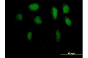 Immunofluorescence of purified MaxPab antibody to ZFP95 on HeLa cell.