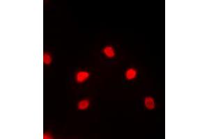 Immunofluorescent analysis of MEF2C staining in PC12 cells. (MEF2C anticorps  (C-Term))