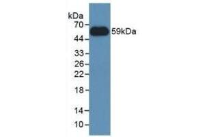 Detection of Recombinant NNMT, Human using Polyclonal Antibody to Nicotinamide-N-Methyltransferase (NNMT)