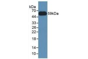 Detection of Recombinant NNMT, Human using Polyclonal Antibody to Nicotinamide-N-Methyltransferase (NNMT) (NNMT anticorps  (AA 1-258))