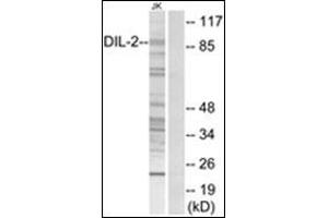 Western blot analysis of extracts from Jurkat cells, using TPX2 Antibody. (TPX2 anticorps  (Internal Region))