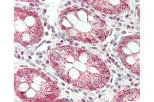 Formalin-fixed and paraffin-embedded H. (NCAPH anticorps  (AA 354-382))