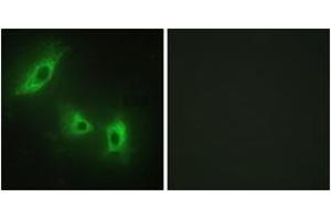 Immunofluorescence analysis of HeLa cells, using ACV1B Antibody. (Activin A Receptor Type IB/ALK-4 anticorps  (AA 73-122))