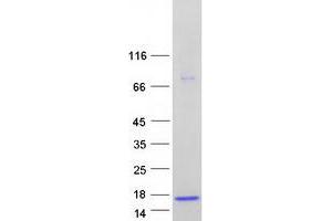 Validation with Western Blot