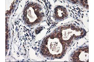 Immunohistochemical staining of paraffin-embedded Human breast tissue using anti-NUDT18 mouse monoclonal antibody. (NUDT18 anticorps)