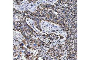 IHC analysis of Aconitase 2 using anti-Aconitase 2 antibody (ABIN7602770). (ACO2 anticorps  (C-Term))