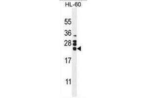 CSF2 Antibody (Center) western blot analysis in HL60 cell line lysates (35µg/lane). (GM-CSF anticorps  (Middle Region))