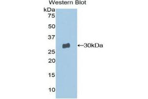 Western Blotting (WB) image for anti-Moesin (MSN) (AA 354-577) antibody (ABIN1859889) (Moesin anticorps  (AA 354-577))