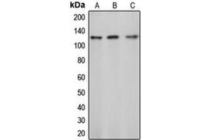 Western blot analysis of c-CBL (pY774) expression in Jurkat (A), mouse liver (B), rat liver (C) whole cell lysates. (CBL anticorps  (C-Term, pTyr774))