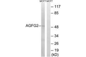 Western Blotting (WB) image for anti-ArfGAP with FG Repeats 2 (AGFG2) (AA 91-140) antibody (ABIN2890377) (AGFG2 anticorps  (AA 91-140))