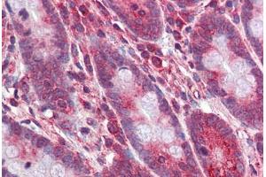 Human Small Intestine: Formalin-Fixed, Paraffin-Embedded (FFPE) (OCA2 anticorps  (AA 468-517))