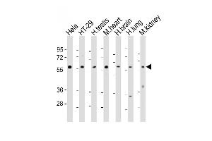 All lanes : Anti-ETV1 Antibody (C-Term) at 1:2000 dilution Lane 1: Hela whole cell lysates Lane 2: HT-29 whole cell lysates Lane 3: human testis lysates Lane 4: mouse heart lysates Lane 5: human brain lysates Lane 6: human lung lysates Lane 7: mouse kidney lysates Lysates/proteins at 20 μg per lane. (ETV1 anticorps  (AA 434-465))