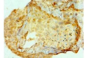 Immunohistochemistry of paraffin-embedded human testis tissue using ABIN7144327 at dilution of 1:100 (AMHR2 anticorps  (AA 18-149))