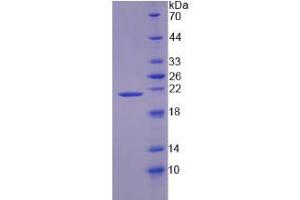Image no. 1 for Zymogen Granule Protein 16 Homolog B (ZG16B) (AA 53-208) protein (His-TRX) (ABIN6236517)