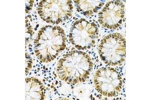 Immunohistochemistry of paraffin-embedded human colon using HNRNPA2B1 Antibody. (HNRNPA2B1 anticorps  (AA 1-180))