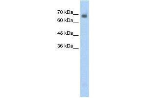 WB Suggested Anti-CRMP1 Antibody Titration:  0. (CRMP1 anticorps  (N-Term))