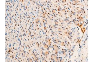 ABIN6267307 at 1/100 staining mouse gastric tissue sections by IHC-P.