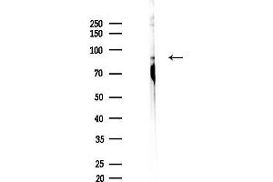 Western blot analysis of lysates from A2780 cells(UV,30 min treatment), using Phospho-MARK3 (Thr507) Antibody at 1/1000 dilution.