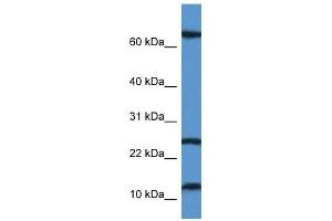 Western Blot showing TARP antibody used at a concentration of 1 ug/ml against Jurkat Cell Lysate (TARP anticorps  (N-Term))