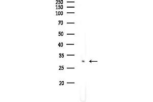 anti-Fibrinogen Silencer Binding Protein (FSBP) (Internal Region) antibody