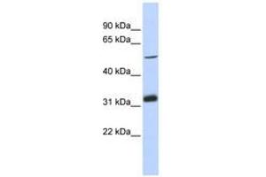 Image no. 1 for anti-Tandem C2 Domains, Nuclear (TC2N) (AA 251-300) antibody (ABIN6741190) (TC2N anticorps  (AA 251-300))