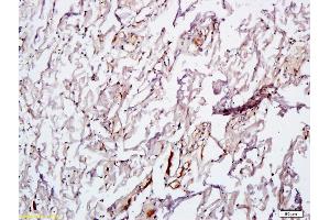 Formalin-fixed and paraffin embedded rat skin tissue labeled with Anti VEGF Polyclonal Antibody,Unconjugated (ABIN674829) at 1:600 followed by conjugation to the secondary antibody and DAB staining. (VEGF anticorps)