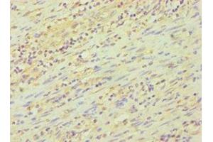 Immunohistochemistry of paraffin-embedded human epityphlon tissue using ABIN7162842 at dilution of 1:100