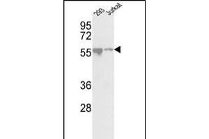 Western blot analysis of CDKL2 Center (ABIN391189 and ABIN2841281) in 293, Jurkat cell line lysates (35 μg/lane). (CDKL2 anticorps  (AA 226-255))
