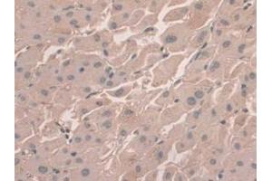DAB staining on IHC-P; Samples: Human Liver Tissue (HFE2 anticorps  (AA 234-416))