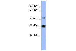 WB Suggested Anti-PRKY Antibody Titration: 0. (PRKY anticorps  (N-Term))