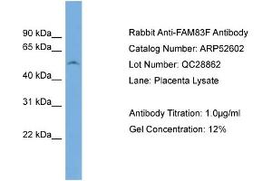 WB Suggested Anti-FAM83F  Antibody Titration: 0. (FAM83F anticorps  (N-Term))