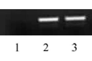 Histone H4 acetyl Lys5 antibody tested by ChIP analysis. (Histone H4 anticorps  (acLys5))